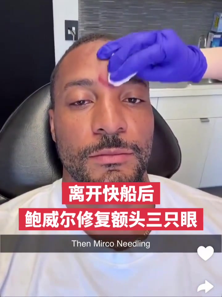 👁关闭天眼！鲍威尔在离开快船后修复额头三只眼