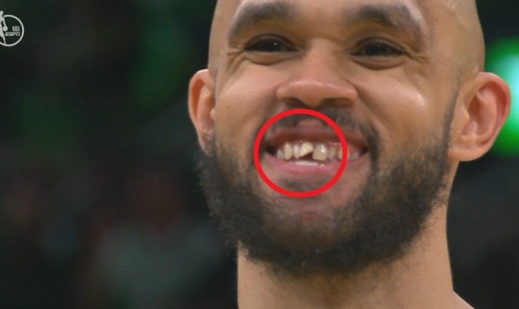 小白谈去年总决赛被打门牙：之后我进了三分 是我最美好回忆之一