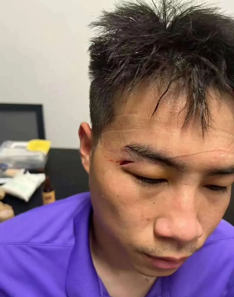 津媒:王献钧两颗门牙被撞断,杨帆眉骨受伤赛后去医院缝针
