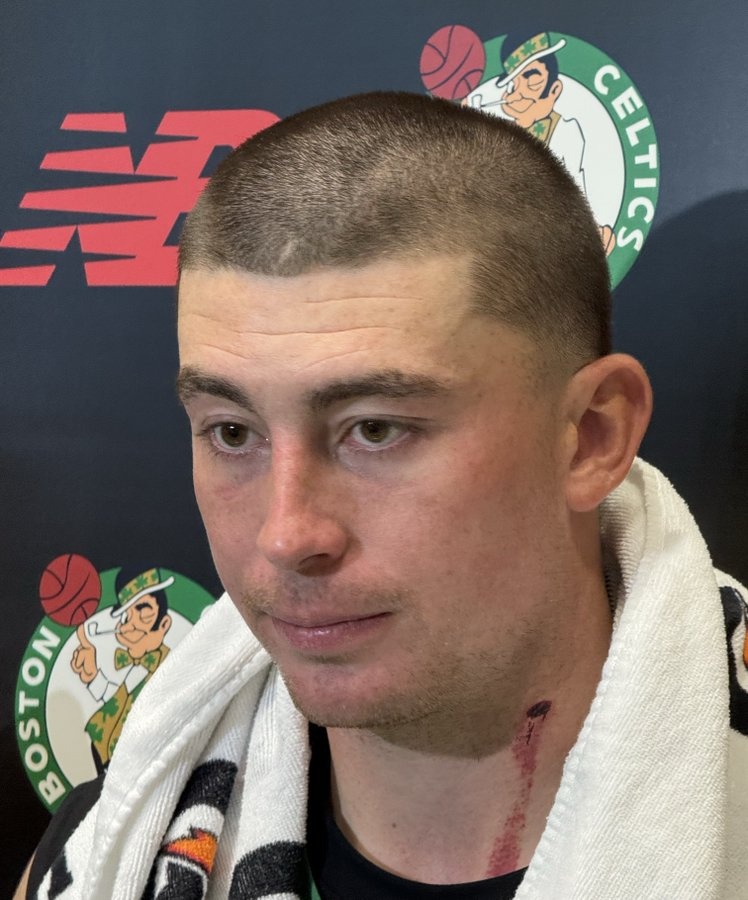 颈部有明显血痕！普理查德：训练营里的对抗像打仗一样