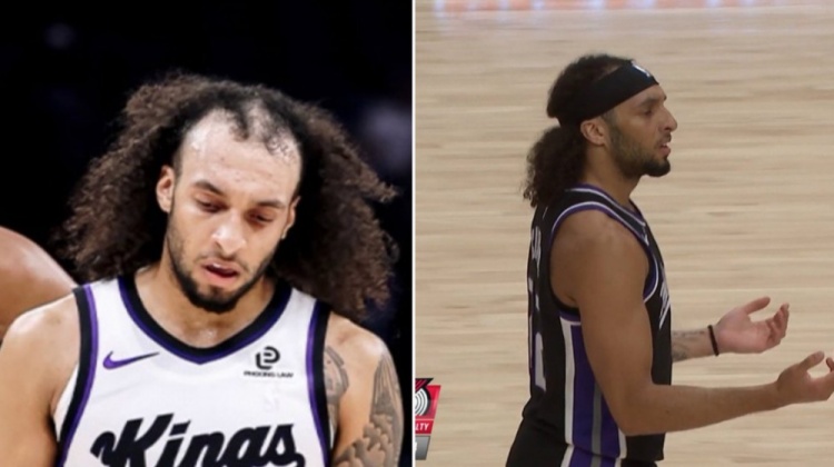 太“秃”然了！互联网的评论让德文-卡特带上了发带！